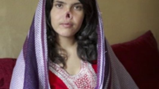 دادگاه قبیله در افغانستان و عایشه که گوش و بینی اش قطع شد!
