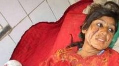 کشتار غير نظاميان و درگيری لفظی ناتو با بخش حقوق بشر سازمان ملل!