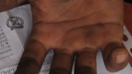 Bloody attacks against Afghan refugees in Greece