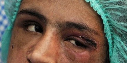 عکس هایی از سحر گل؛ افغانستان قربانیان بسیار چون سحرگل دارد