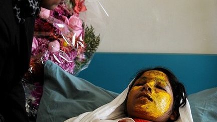 اسید پاشی جنایتکاران افغان به صورت دختران دانش آموز در قندهار