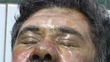 عاملان حمله بر رزاق مامون باید محاکمه و مجازات علنی شوند