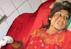 کشتار غير نظاميان و درگيری لفظی ناتو با بخش حقوق بشر سازمان ملل!