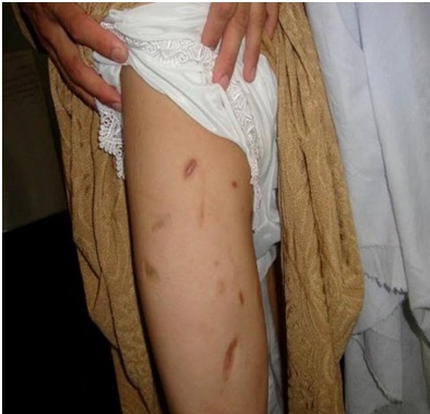 هشتم مارچ روز جهانی زن و ادامه خشونت علیه زنان