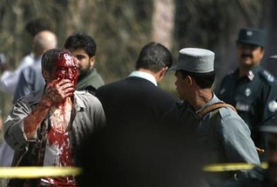 صحنه های خونین انفجار دوشنبه از چشم دوربین