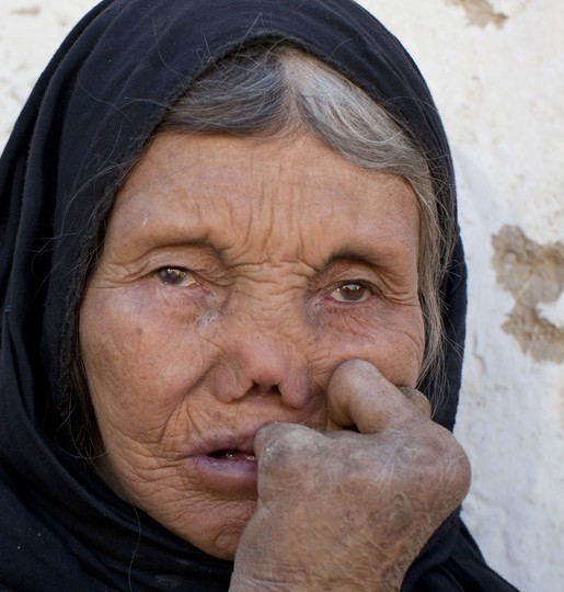 یکاولنگ: جذام، 9 سال پس از قتل عام توسط جنایتکاران طالب